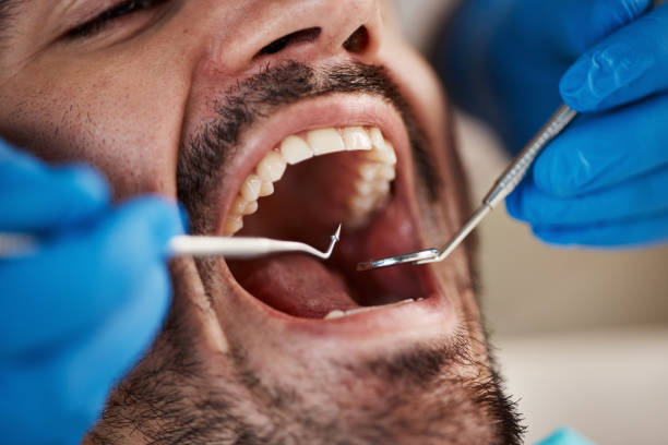 Best Broken or Chipped Tooth Repair in Pocono Woodland Lakes, PA