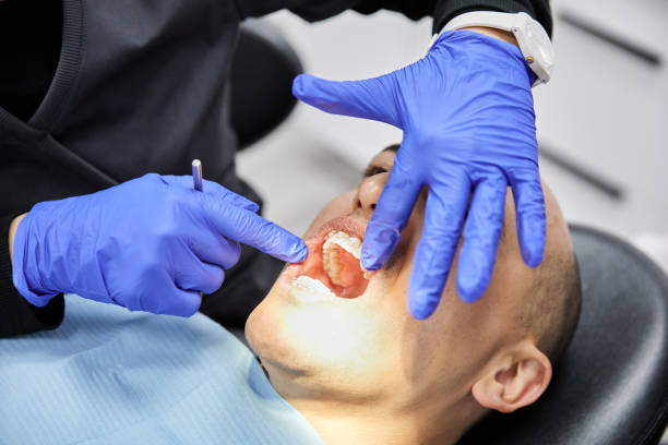 Best Emergency Dental Care for Sports Injuries in Pocono Woodland Lakes, PA
